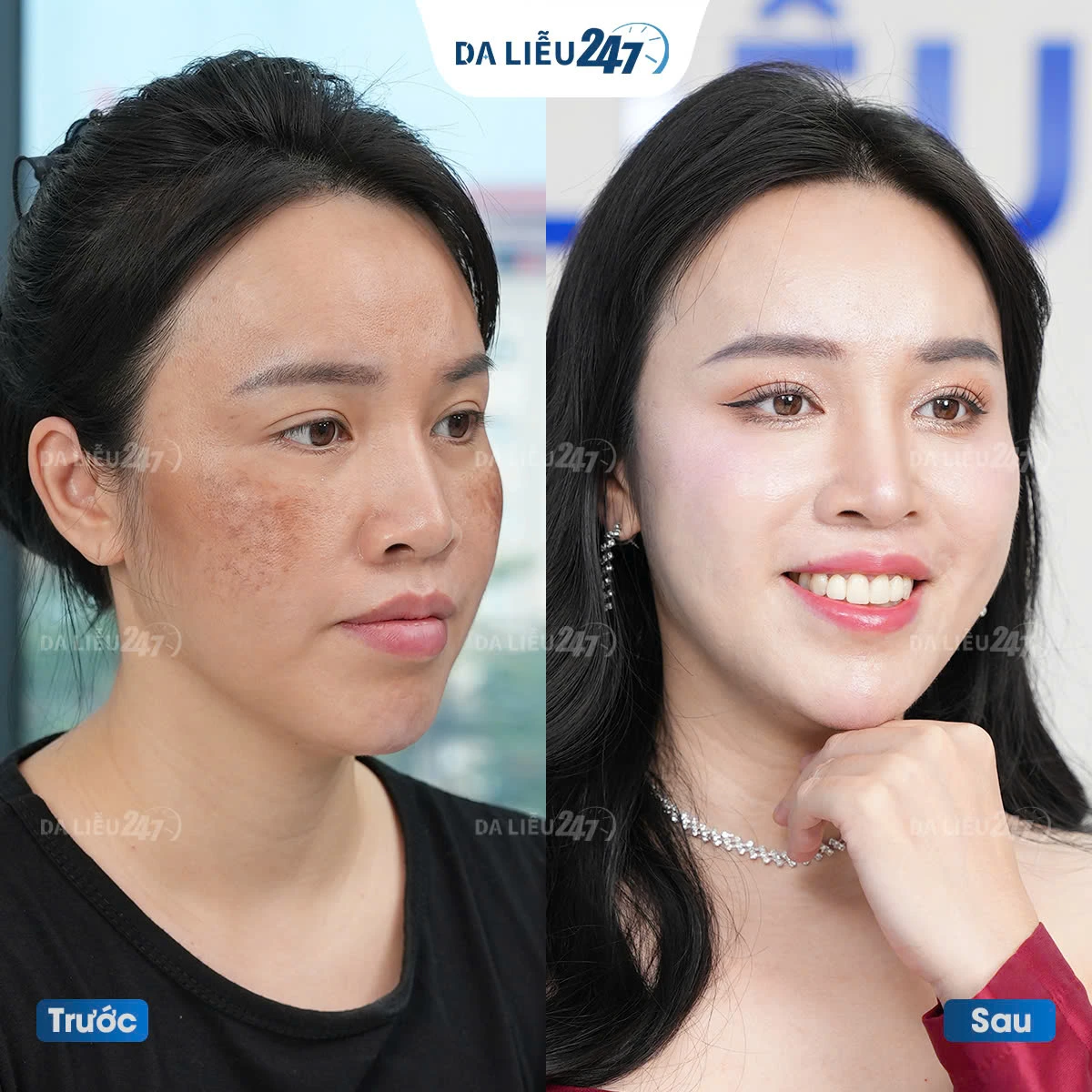 Lưu bản nháp tự động